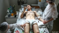 Алексей Курачев в больнице скорой медицинской помощи в Минске. Фото: Вадим Замировский, TUT.BY