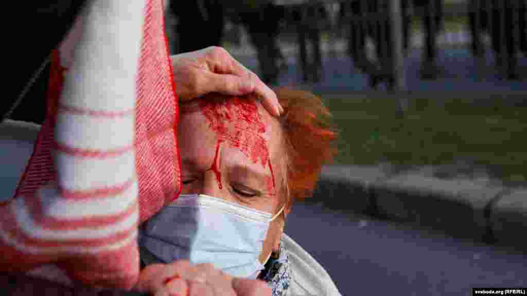Пострадавшая во время разгона демонстрации 23 сентября в Минске. Тогда в столице Беларуси и других городах прошли массовые акции протеста, вызванные инаугурацией Лукашенко. Силовики жестко действовали в отношении протестующих, в Минске применили водометы и перцовый газ. МВД сообщило о 364 задержанных, из них 252 – в Минске.